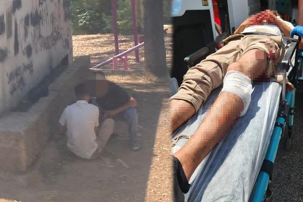Tartıştığı kişiyi bacağından vurup başında bekledi! İfadesi pes dedirtti: “5 bin TL alacağım vardı”