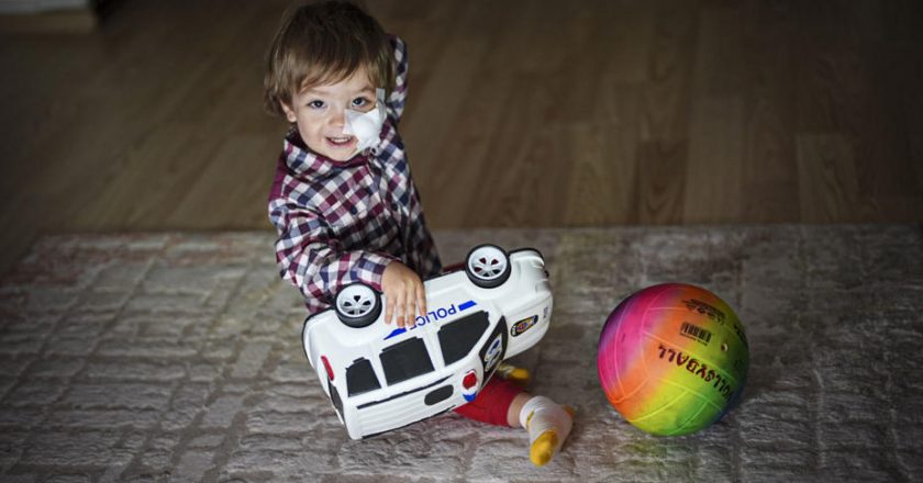 Pitbull saldırısının ardından küçük Efe hastaneden çıktı